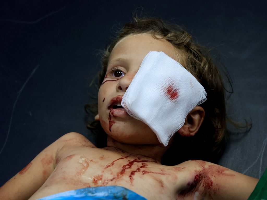 Mi allenavo per guarire gli occhi a Gaza. Poi tutto è andato buio