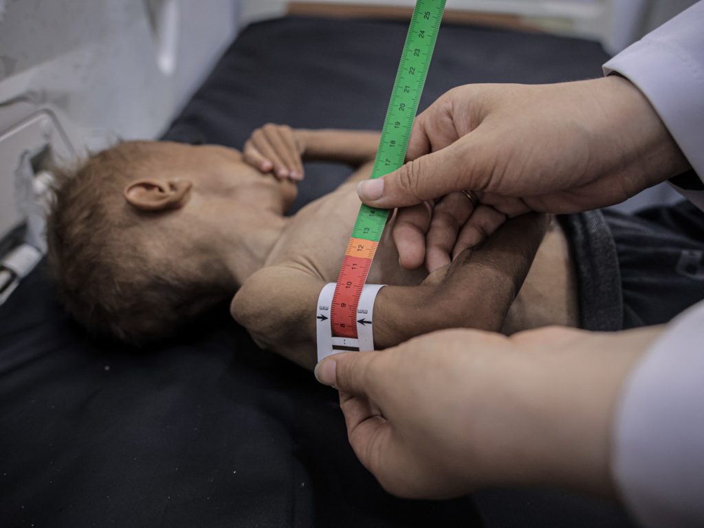 Il cibo da solo non salverà la popolazione affamata di Gaza