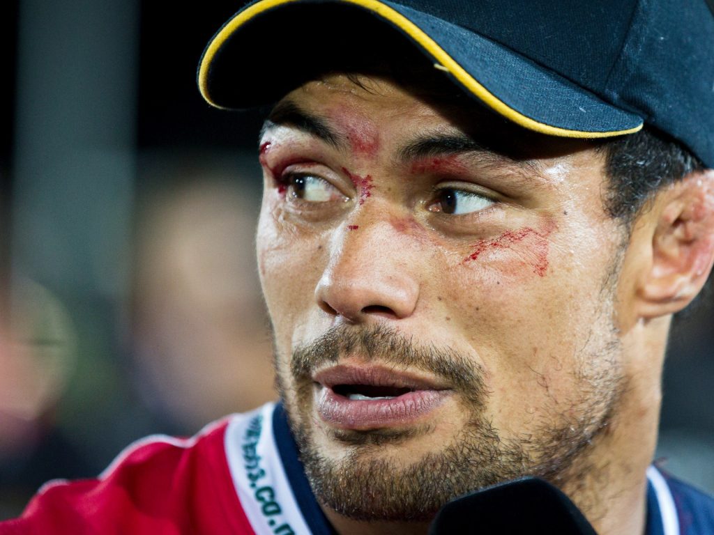 Il giocatore di rugby neozelandese che ha chiesto lo studio delle commozioni cerebrali muore a 39