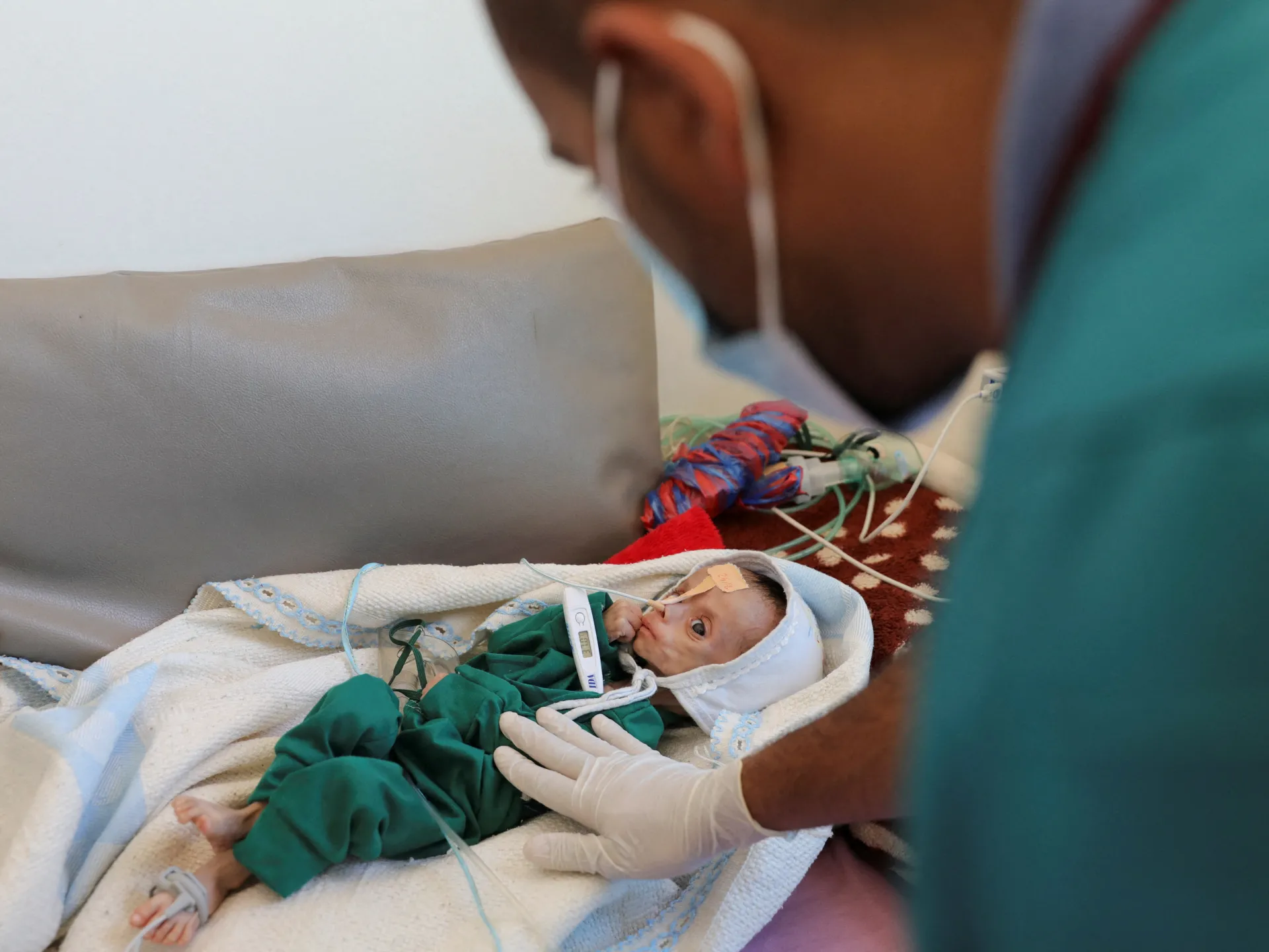 La fame incombe sullo Yemen, sono necessari interventi urgenti