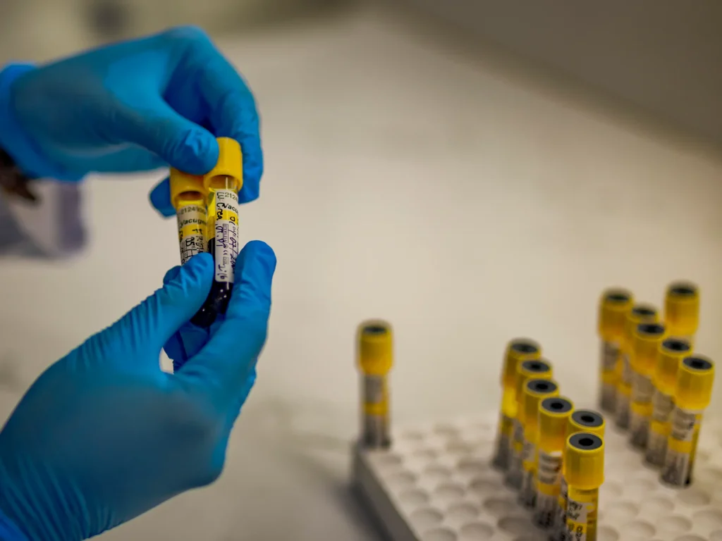 Una generazione libera dall’AIDS è a portata di mano, ma non è garantita