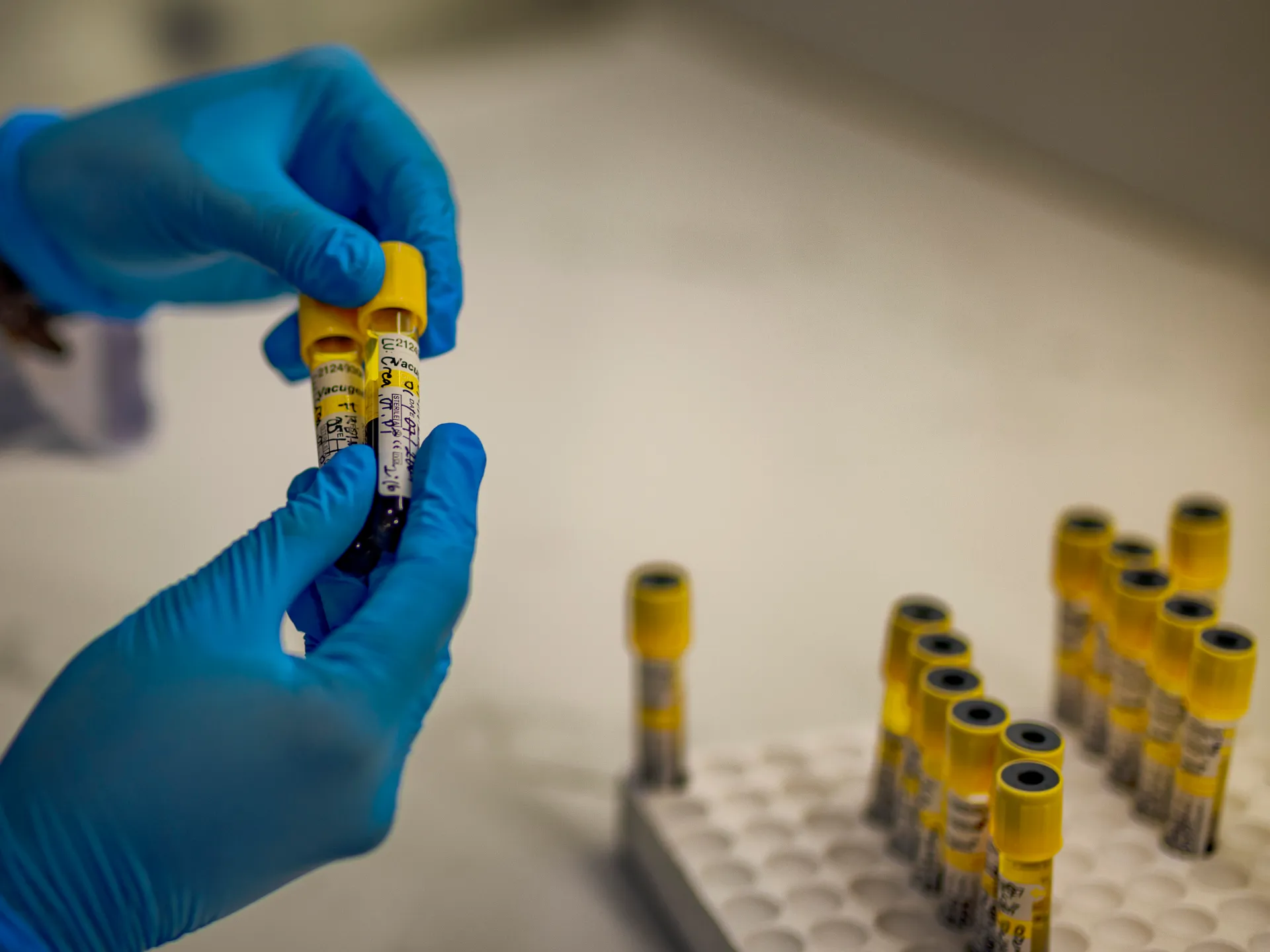 Una generazione libera dall’AIDS è a portata di mano, ma non è garantita
